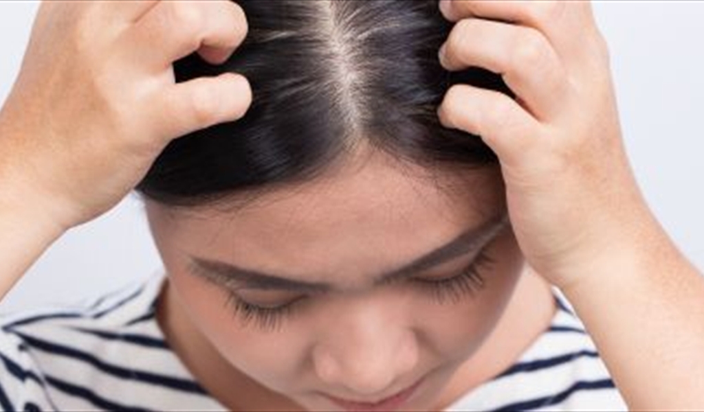 لا يطير من رأس لآخر.. 5 معلومات خاطئة عن قمل الرأس يجب أن تعرفوها