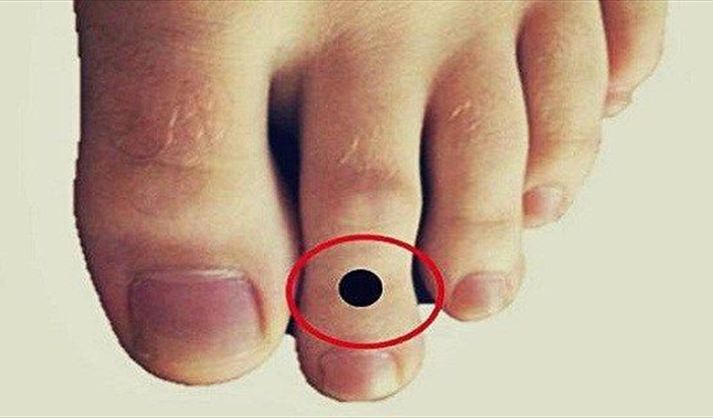 هل إصبع قدمك الثاني أطول من أصابعك الأخرى... إقرأ هذا الخبر!