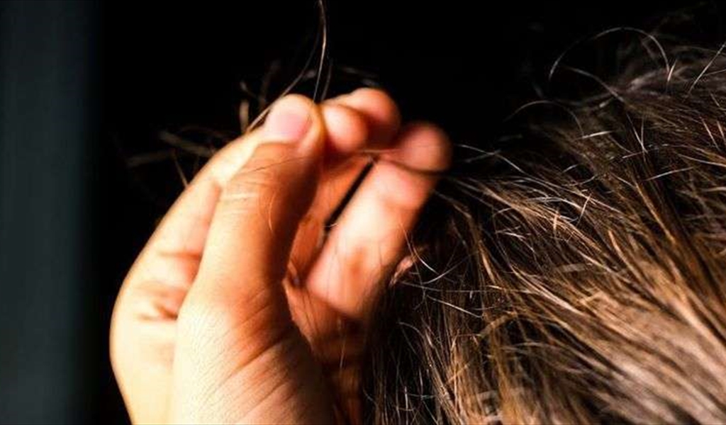 هوس نتف الشعر اضطراب نفسي سرّي ولكنّ له علاجاً!