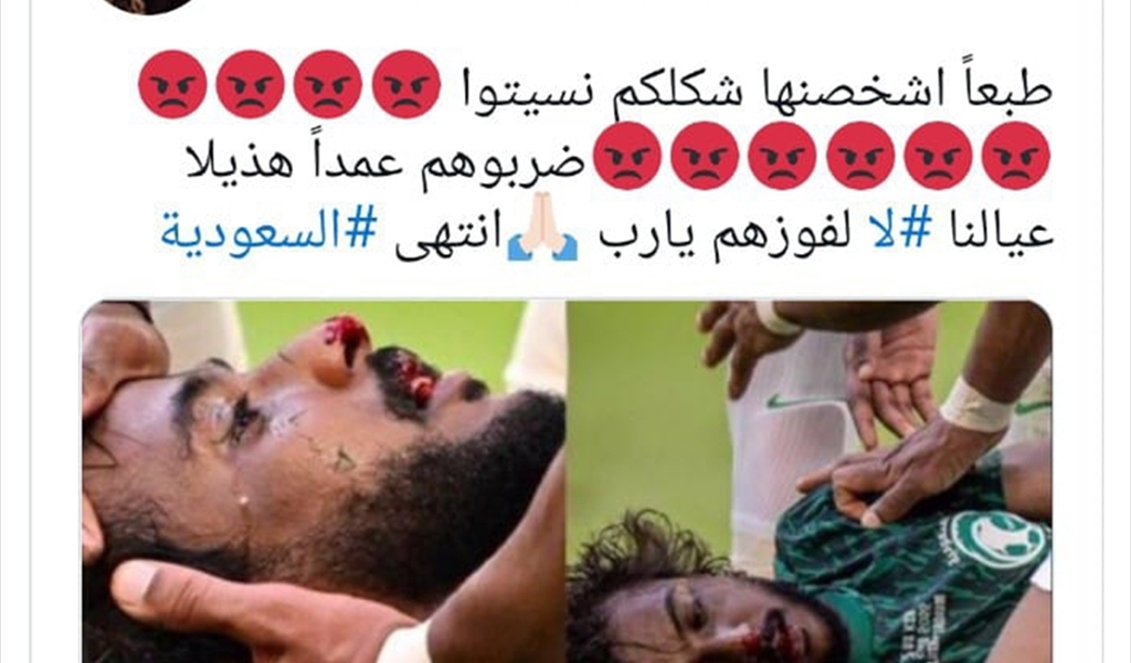 سجال مونديالي صاخب بين العفاسي واحلام بسبب ميسي
