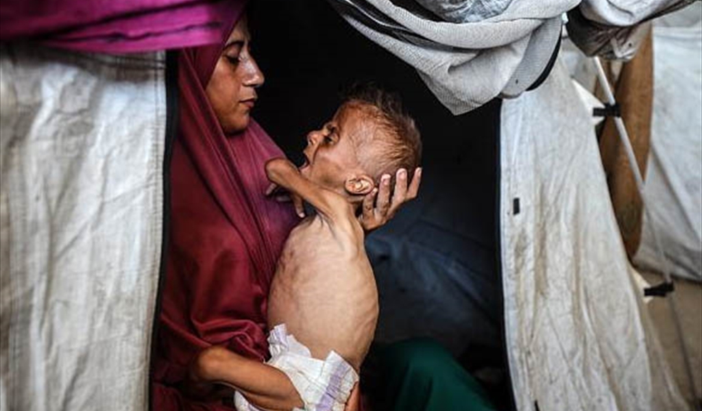 مشهد الجوع الفظيع يتجسد في طفل فلسطيني في حضن أمه في غزة