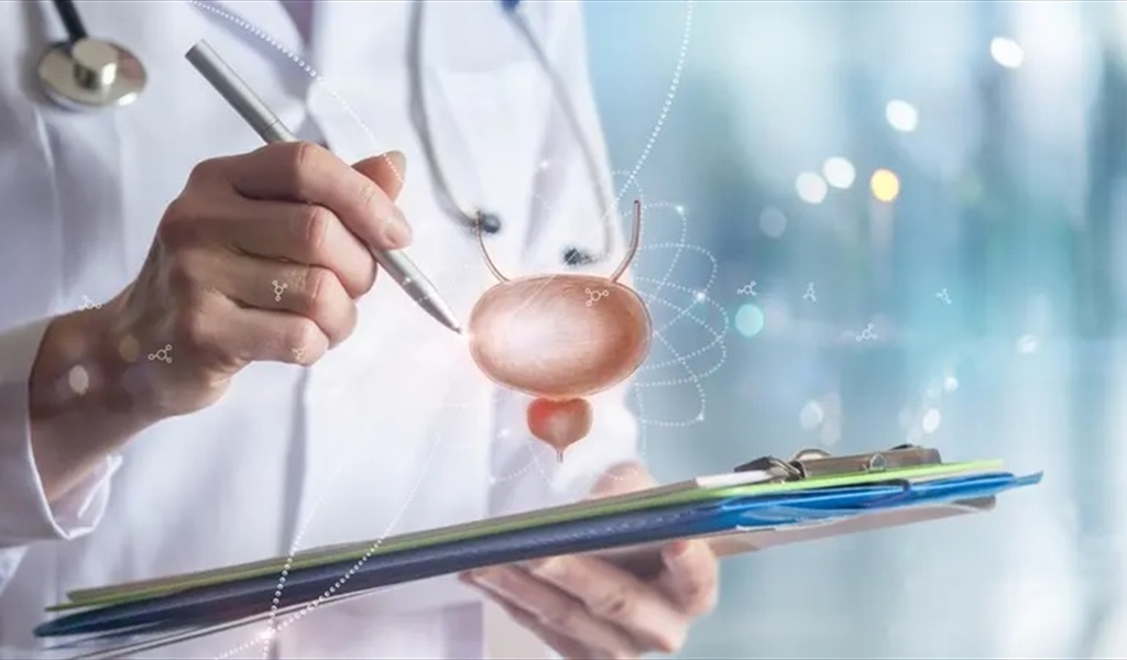 ما الذي يجب أن يعرفه الرجال  عن اختبار سرطان البروستاتا؟