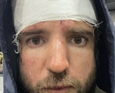 المواطن الروسي المتنكر تعرض لإصابات في رأسه
